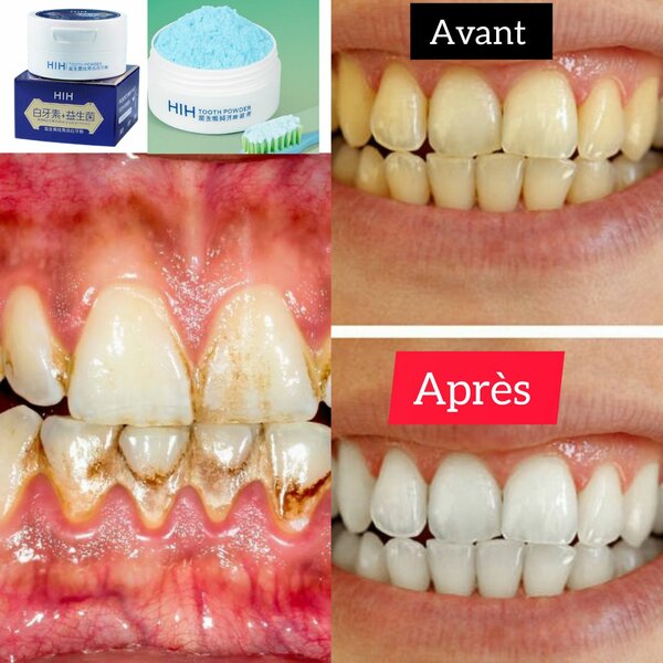 Poudre Dentaire Blancheur