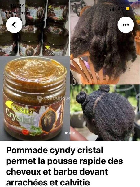 Pommade Croissance Cheveux
