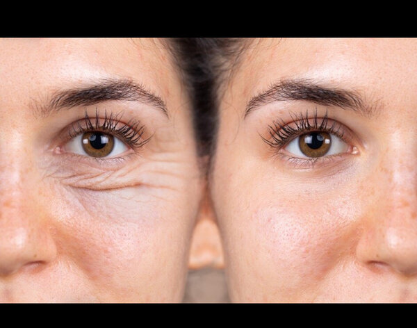 Masques pour les Yeux Hydratants