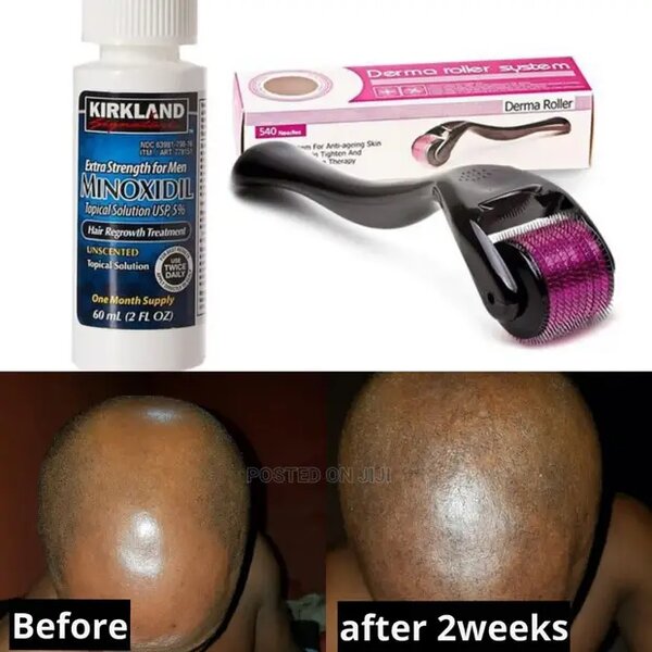 Kirkland minoxidil & Derma Roller For Baldness Growth
