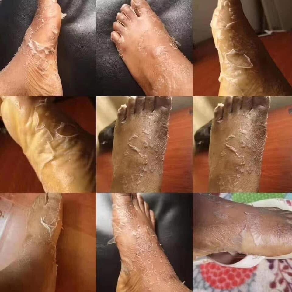 Lotion Peeling Exfoliant