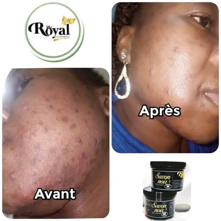 Savon Noir Naturel Royal
