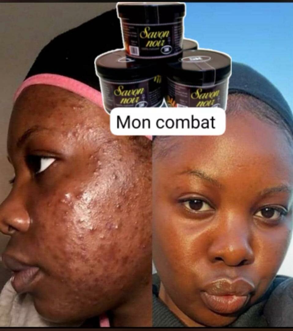 Savon Noir Purifiant Naturel