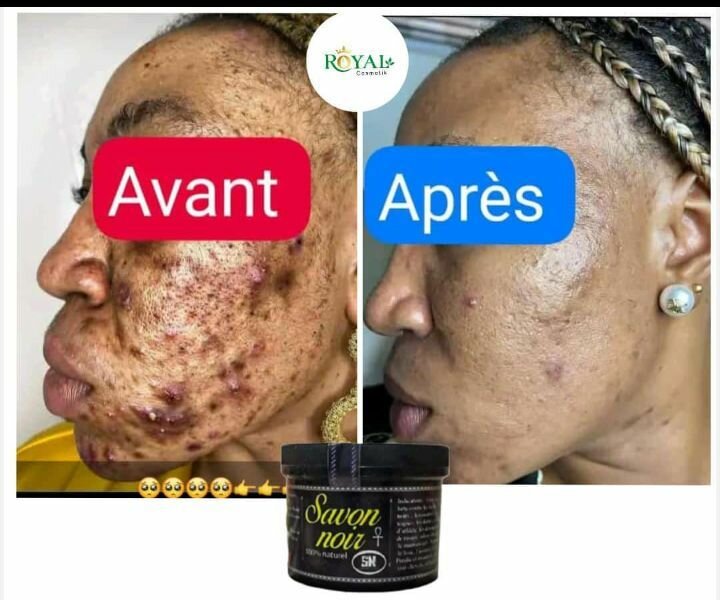 Savon noir naturel.