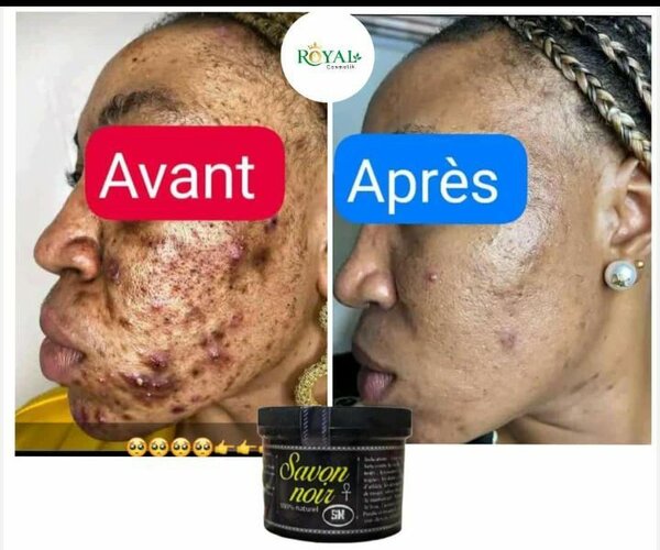 Savon noir naturel.