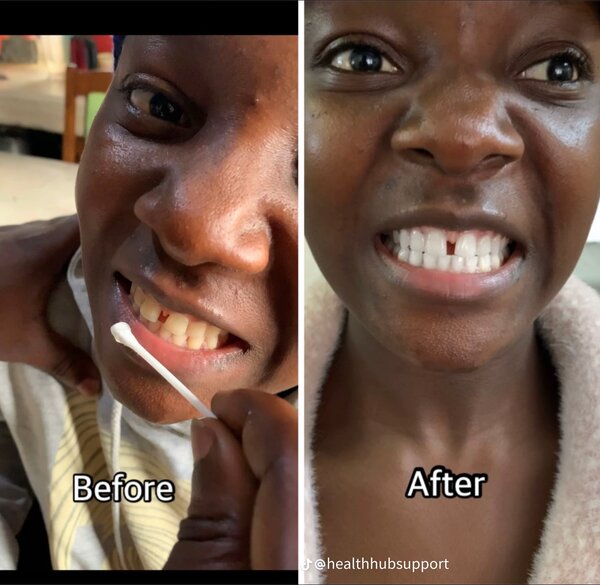 Éssence Blanchissante Dentaire