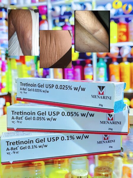 Creme de Tretinoïne