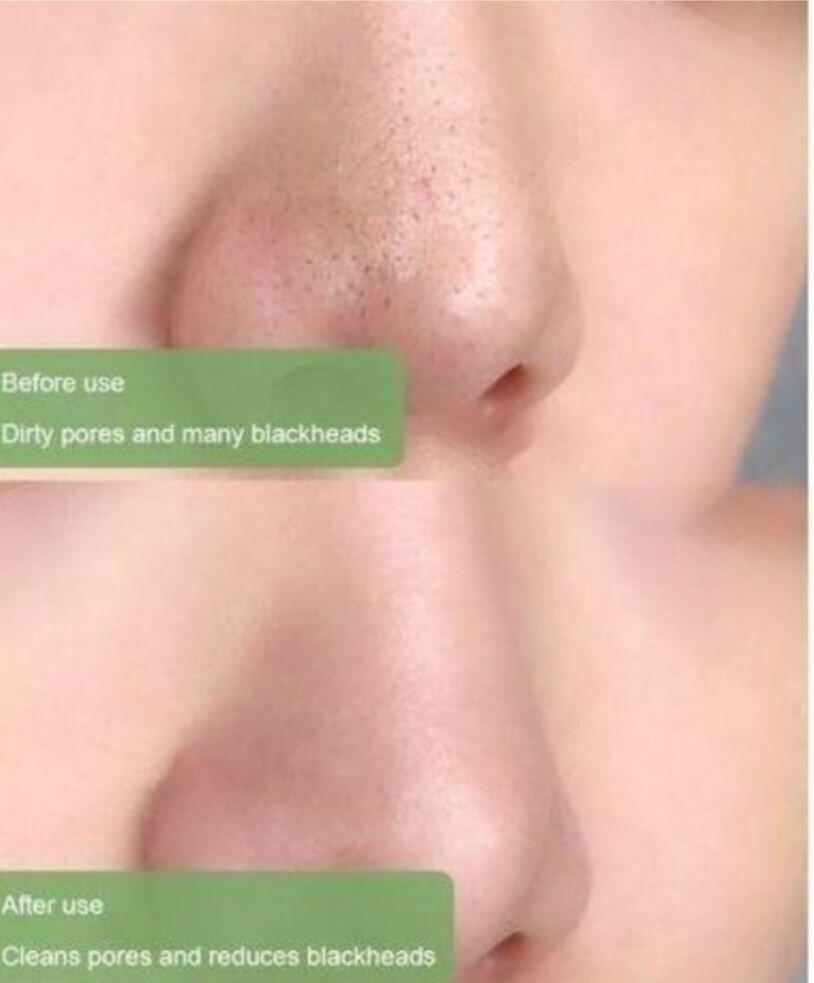 Stick Anti-imperfections Meidían