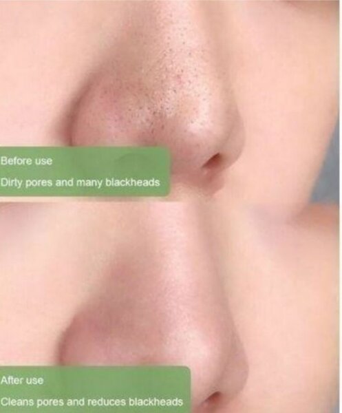 Stick Anti-imperfections Meidían