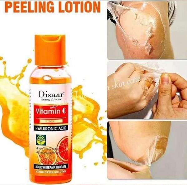 Peeling lotion