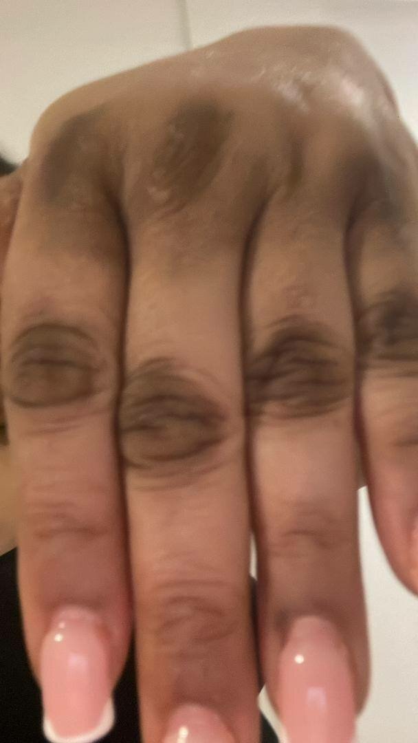 Huile peeling, quinto tâches