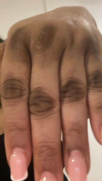 Huile peeling, quinto tâches