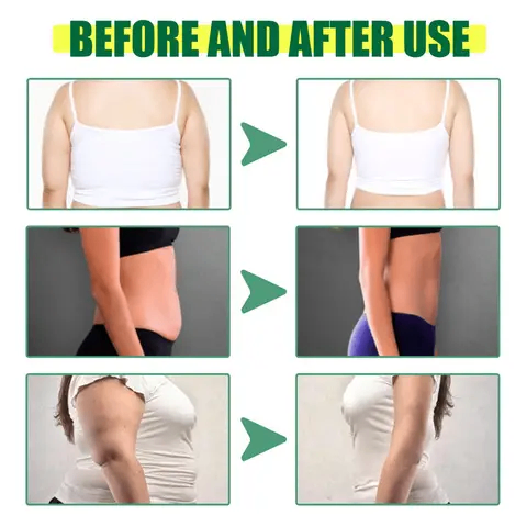 Spray Amaincissant brûle  graisses