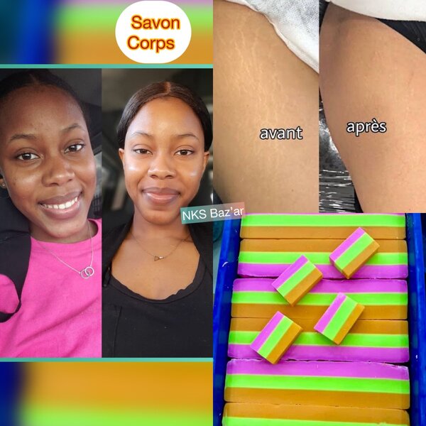 Atténue les vergetures et élimine les taches