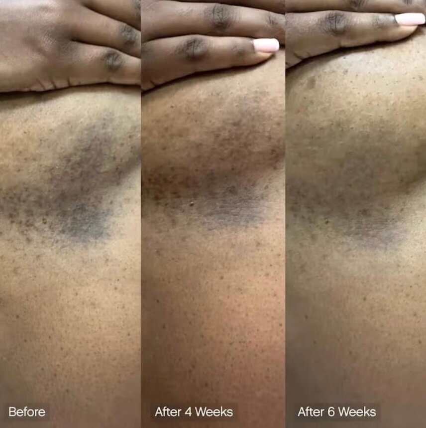 Faded Brightening Soap Bar