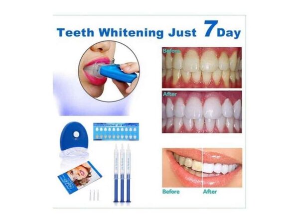 Blanchisseur dentaire