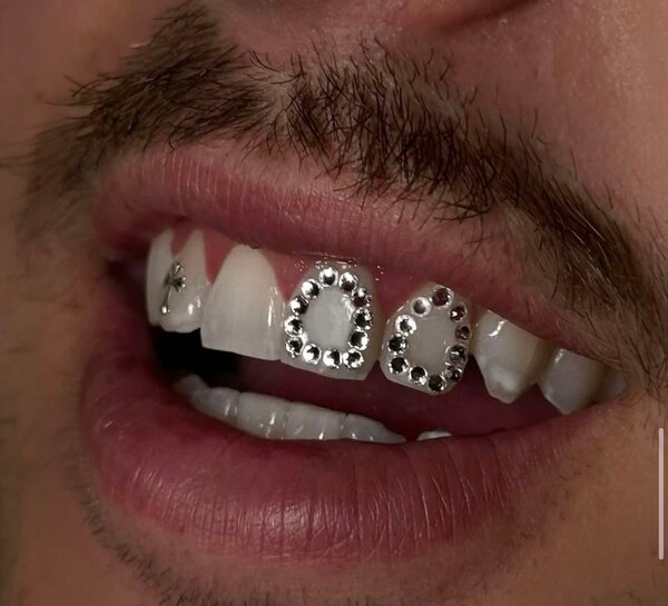 Kit strass dentaires