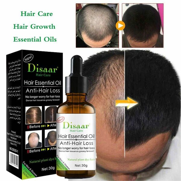 DISAAR Hair Growth Essential Oil Anti Hair Loss Treatment 30