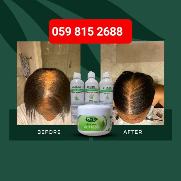 Rhabs Aloe Vera Hair Growth & Treatment Set