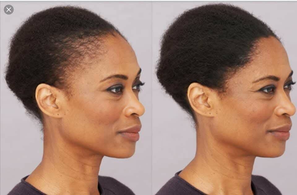 Fibre capillaire kératine