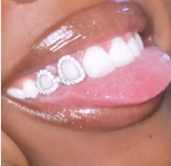 étoiles dentaires en or