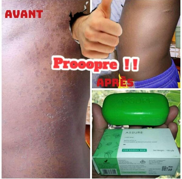 Savon Assure Neem Tulsi