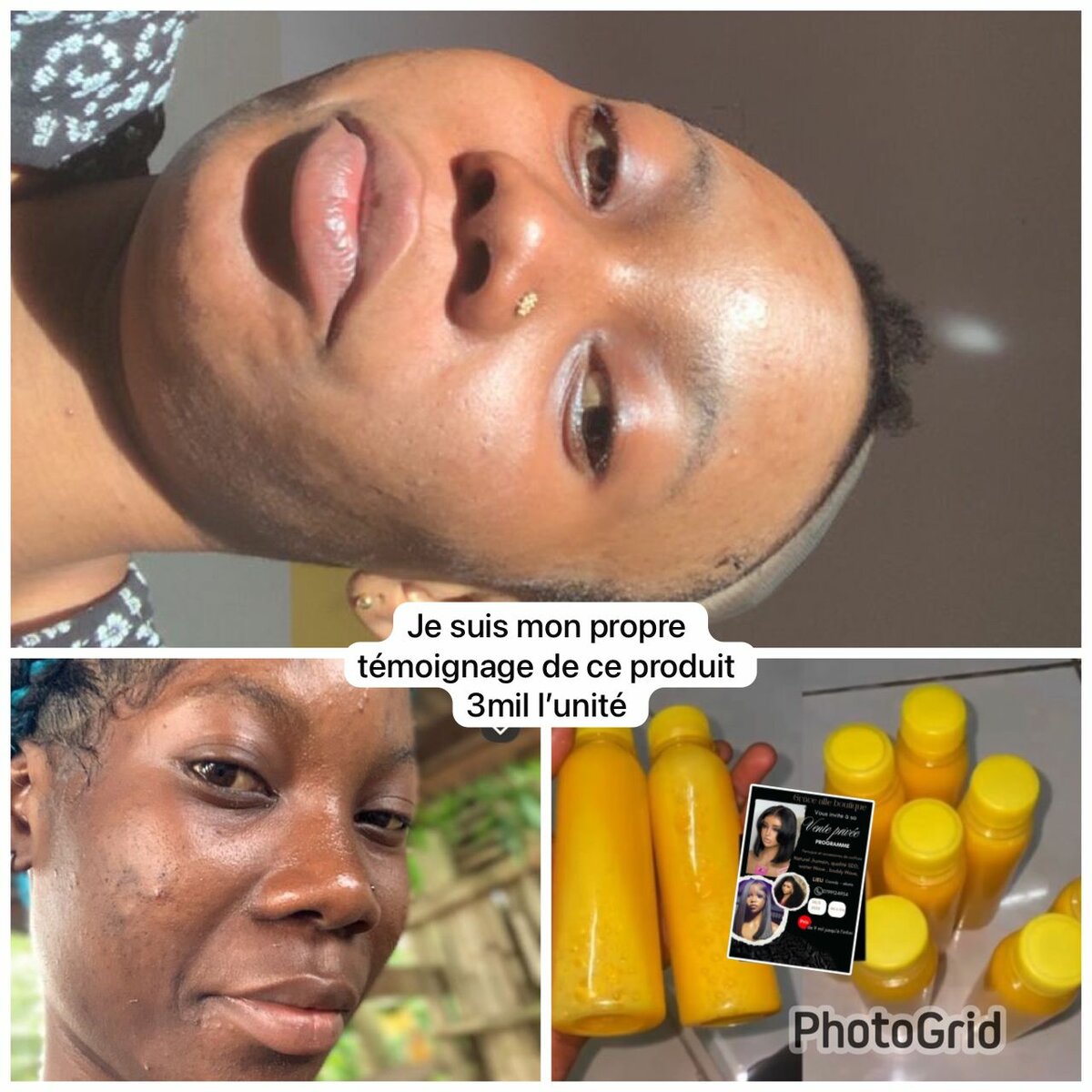 Produit pour les imperfection