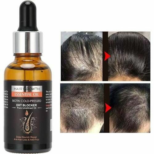 Dermaroller  facial  plus pousse cheveux