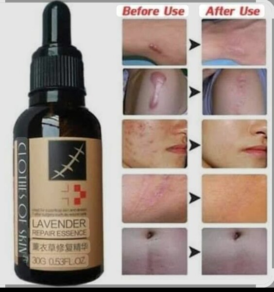 Essence réparatrice lavande cicatrices
