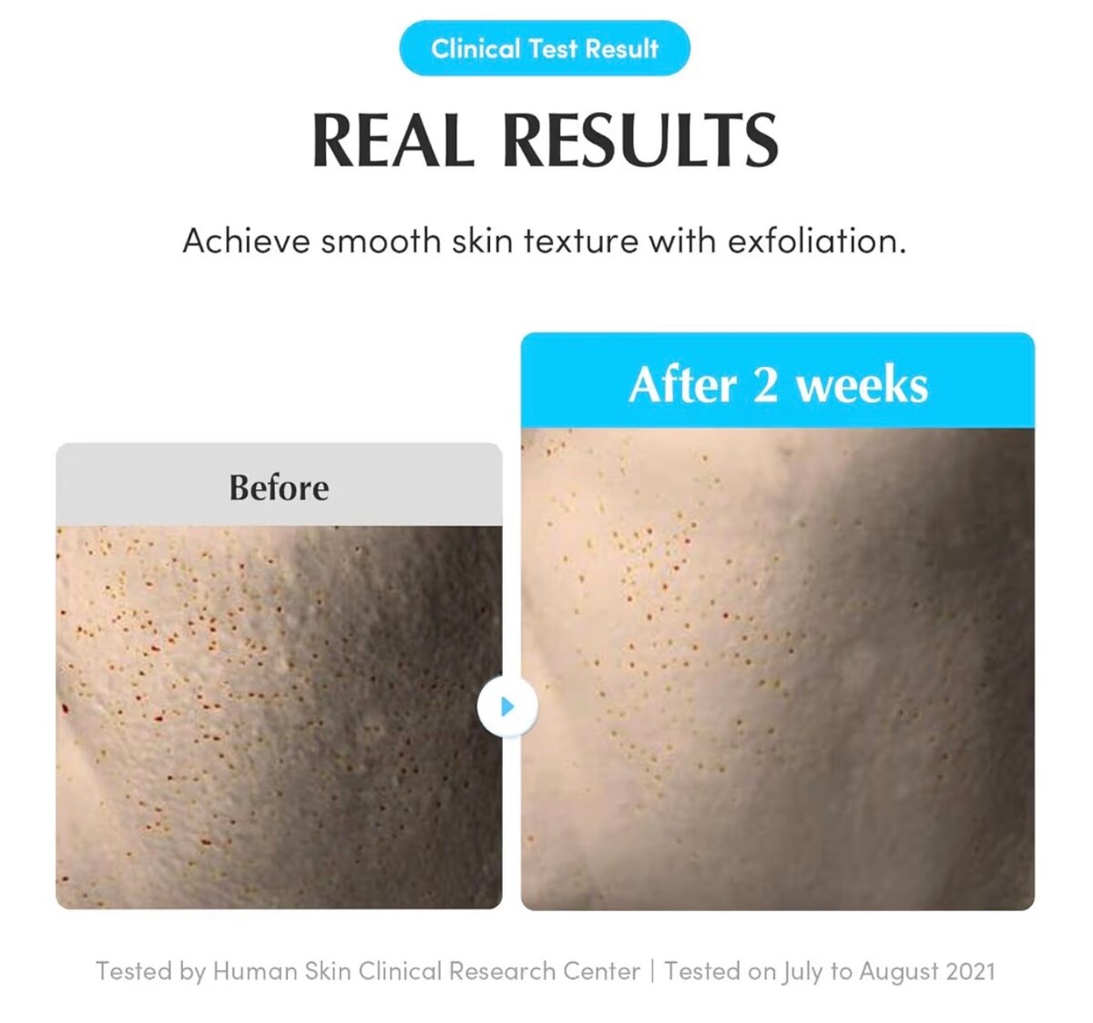 EQUALBERRY Swimming Pool Toner