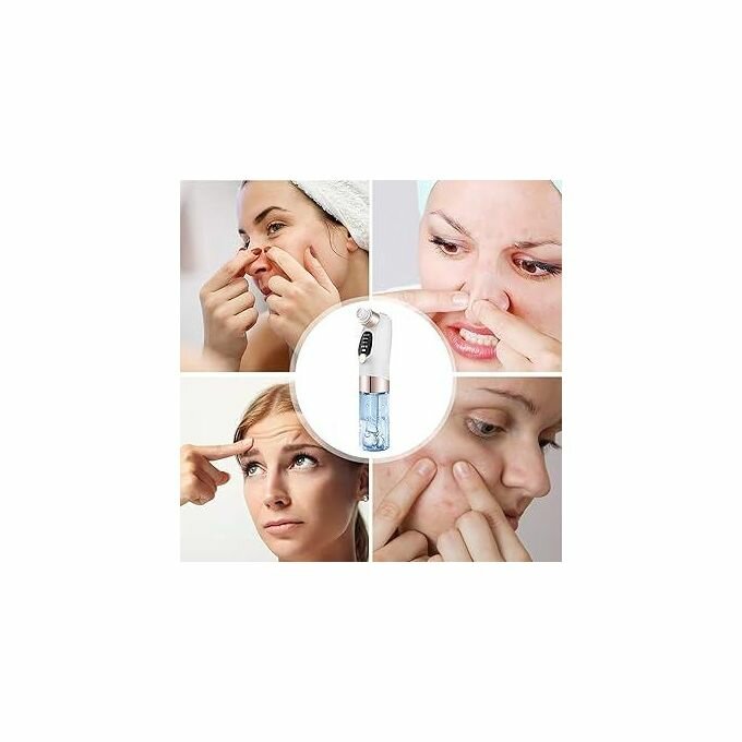 Aspirateur de Points Noirs