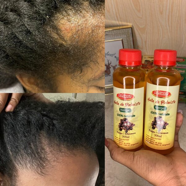 Huile de Palmiste Vierge Cheveux