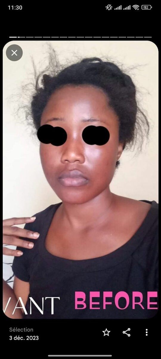 Gamme Métamorphose teint lumin