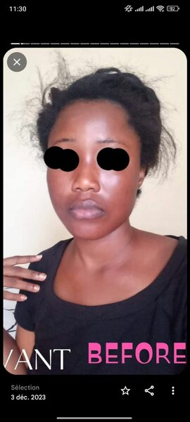 Gamme Métamorphose teint lumin