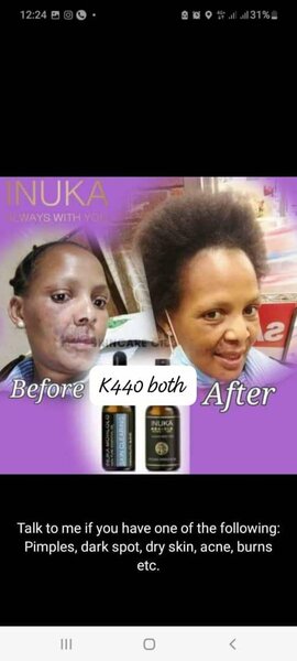 Skin clearing combo