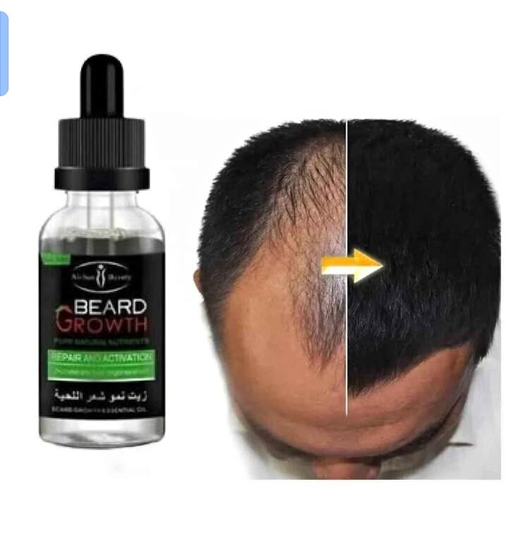 Fini avec la calvitie