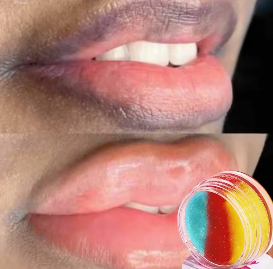 Lip Scrub