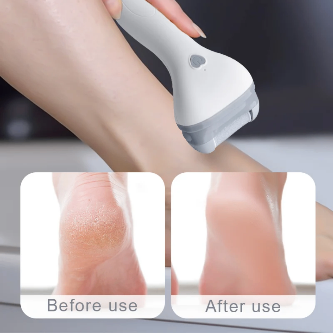 Râpe Pied Électrique USB