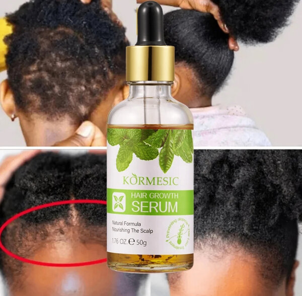 Körmesic Pack Capillaire