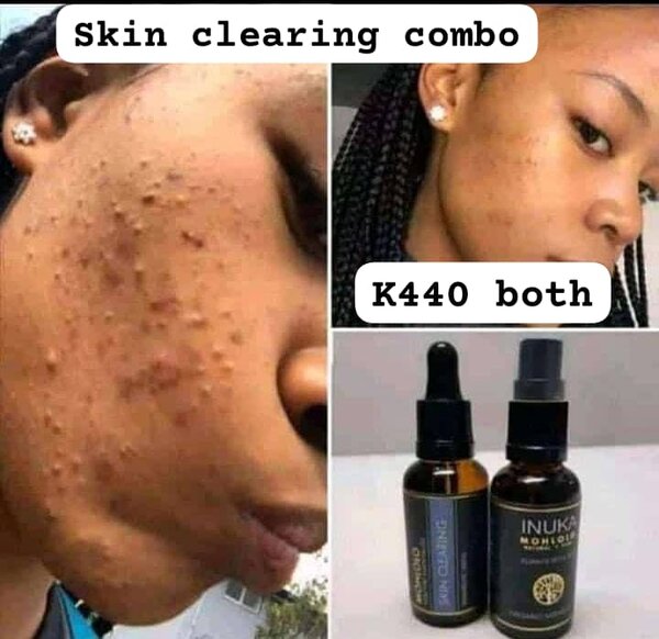 Skin clearing oils combo