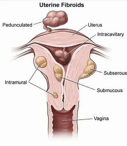 Perles Détox Yoni Naturelles