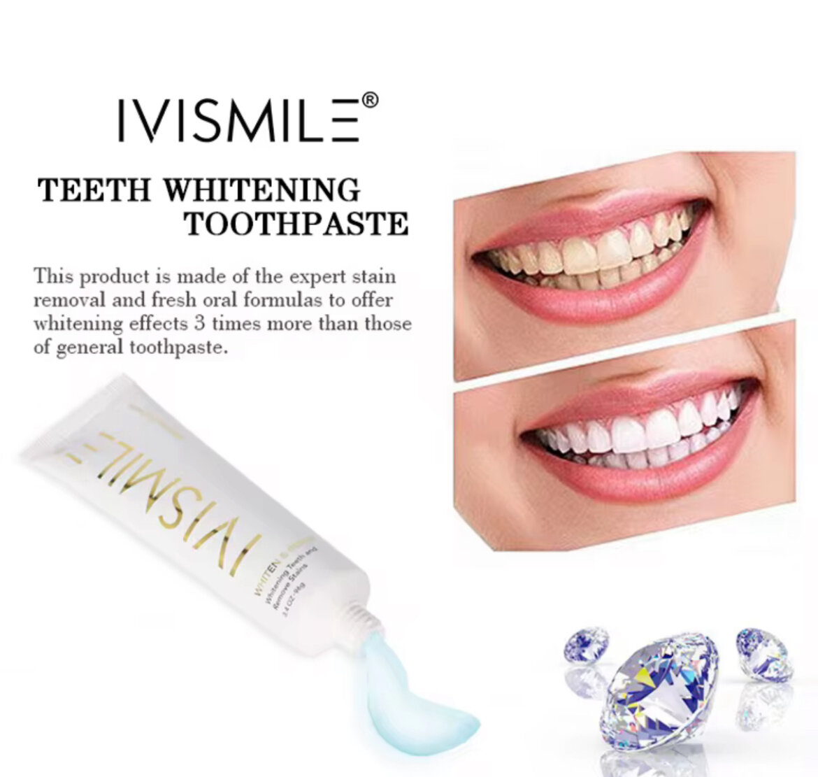 IVISMILE Dentifrice Blanchissant