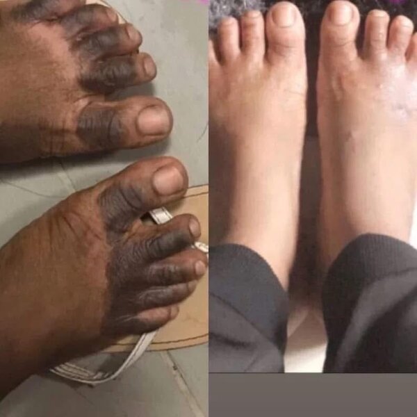 Lotion Peeling Exfoliant