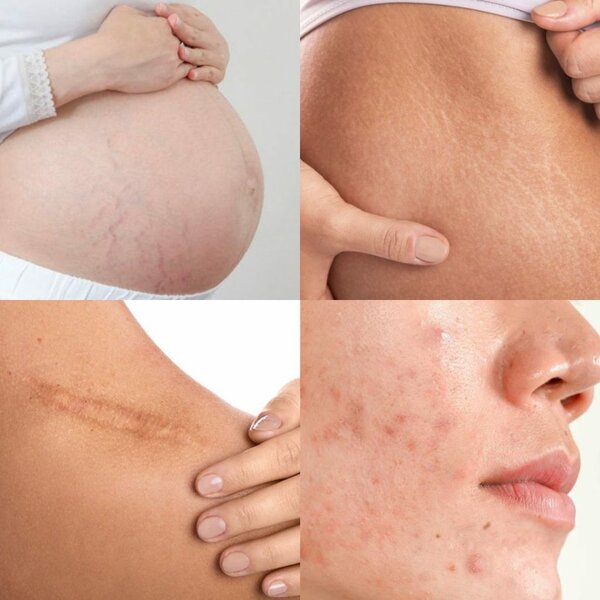 Bio-Oil Skincare Oil 60ml