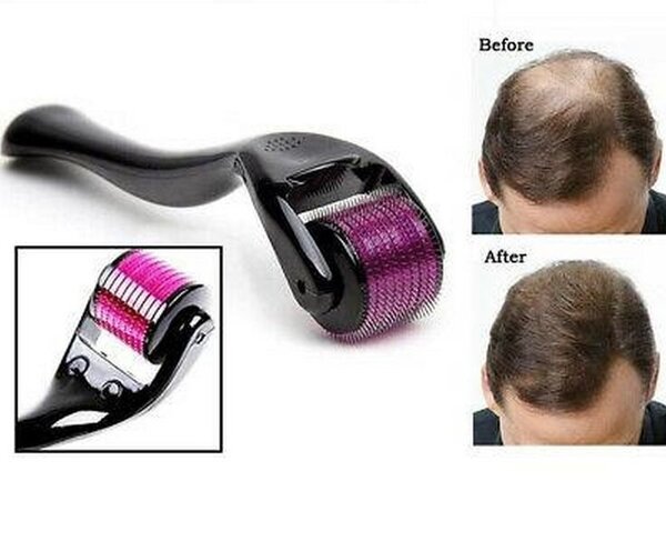 Rouleau Dermaroller Cheveux