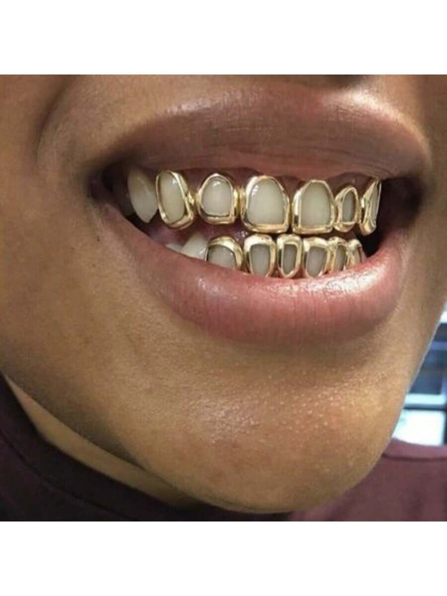 Grillz dentaires