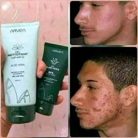 Arvea