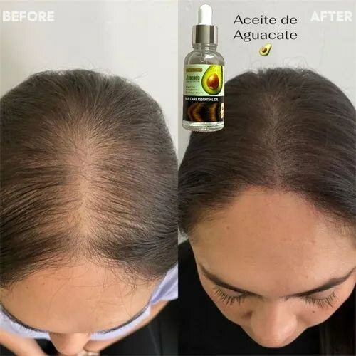 Sérum pour les cheveux