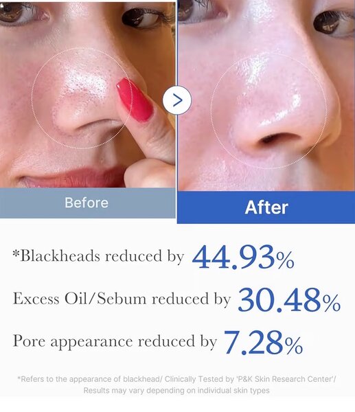 Medicube Zero Pore Pads