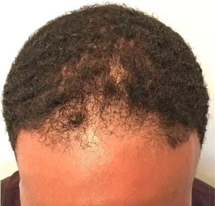 Huile de cheveux Renaissance